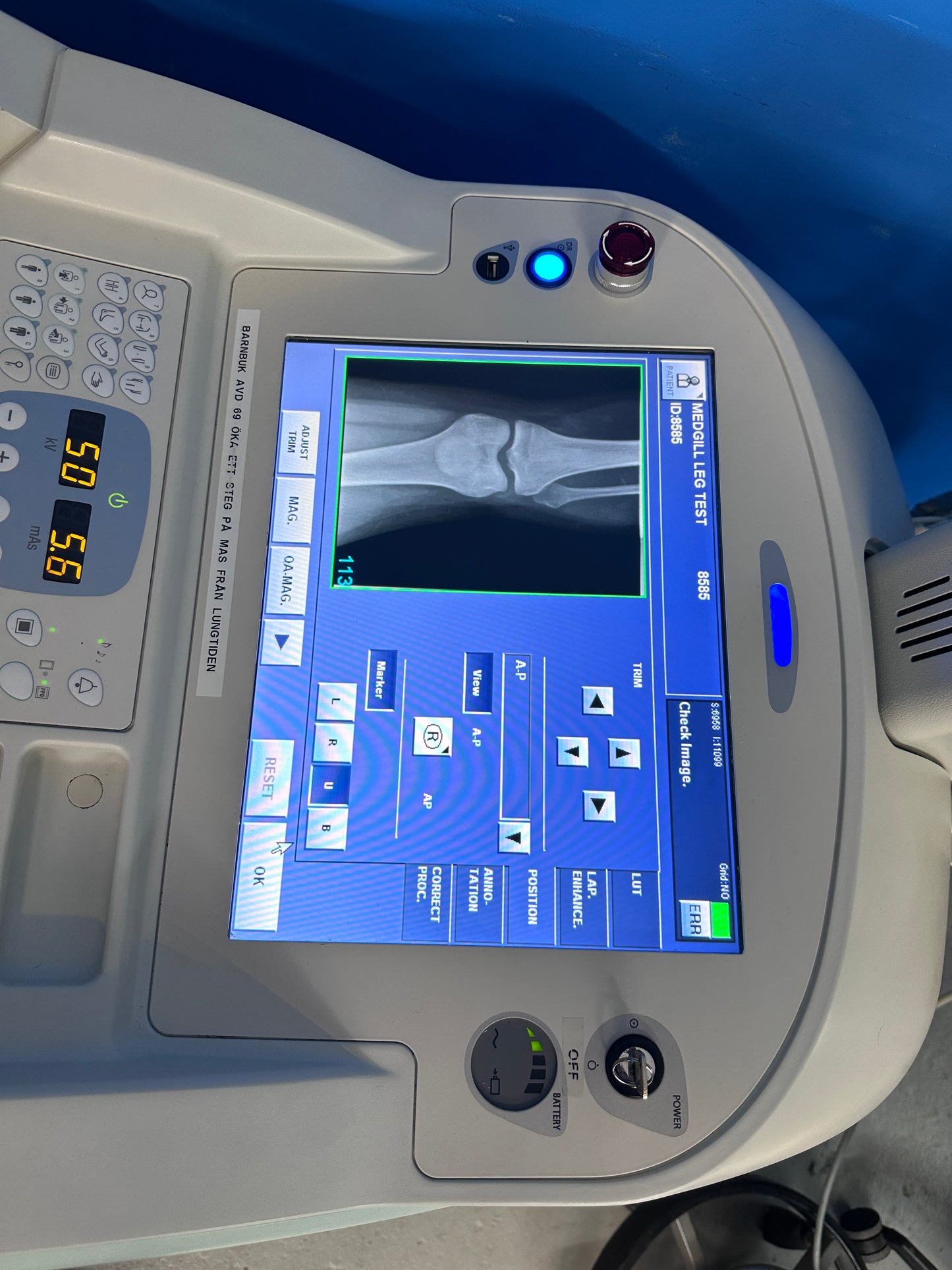 SHIMADZU MobileDaRt Evolution Portable X-Ray