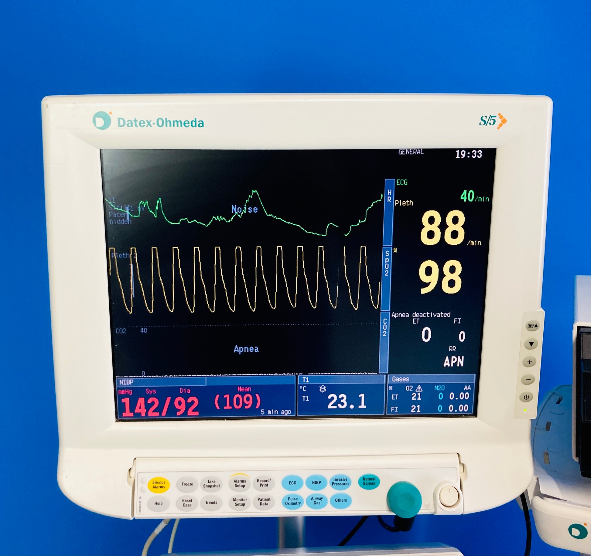 Four display options with integrated monitor controls: 15" or 17" high resolution color video display and 10.4" or 15" flat panel color LCD display