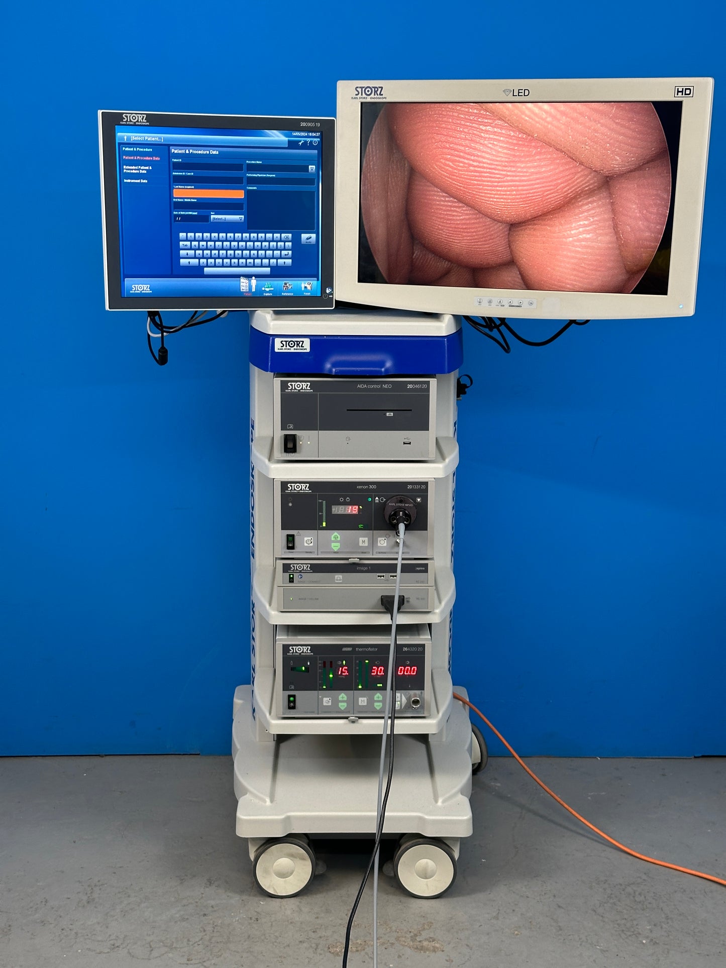 Karl Storz IMAGE1 S™ Spies is a modular camera platform that combines various technologies (e.g., rigid, flexible, and 3D endoscopy as well as FULL HD and 4K imaging). NIR/ICG Fluorescence.