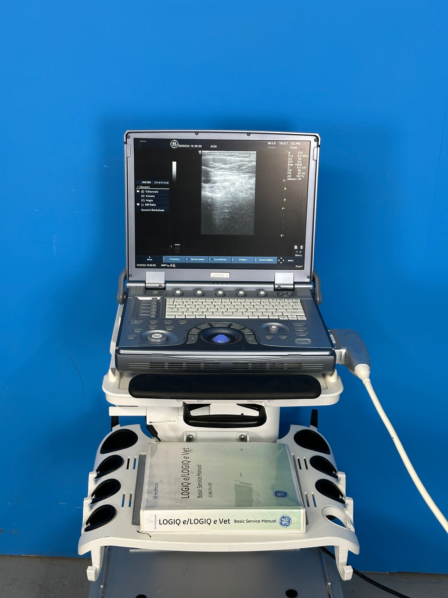Logiq e automatically recalls all of the imaging parameters, comments and body patterns to be identical to your previous exam