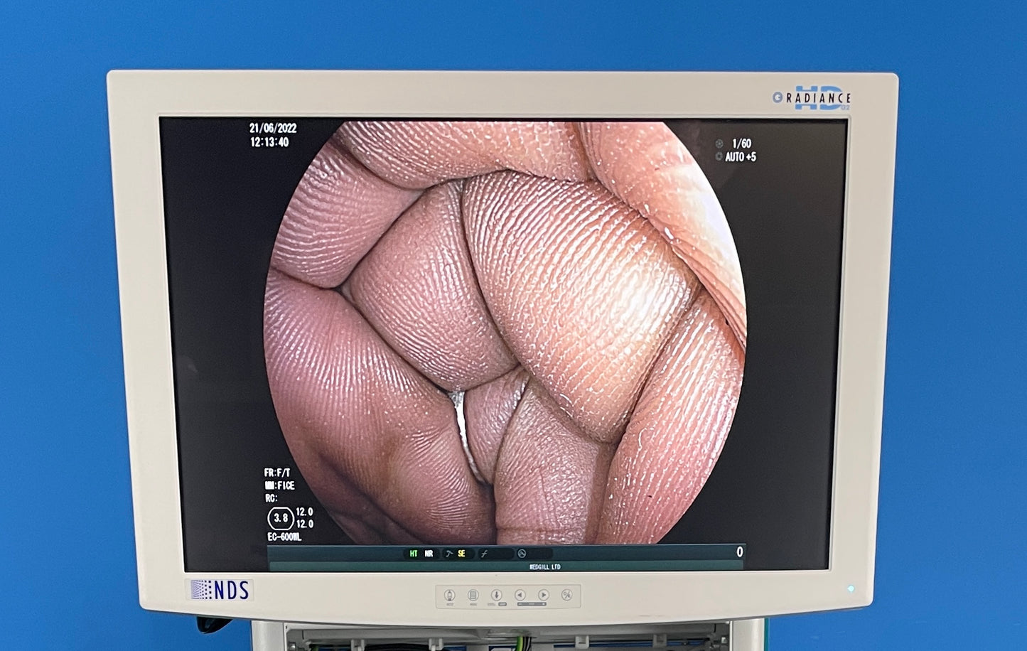 Radiance NDS Monitor shows excellent image on the screen