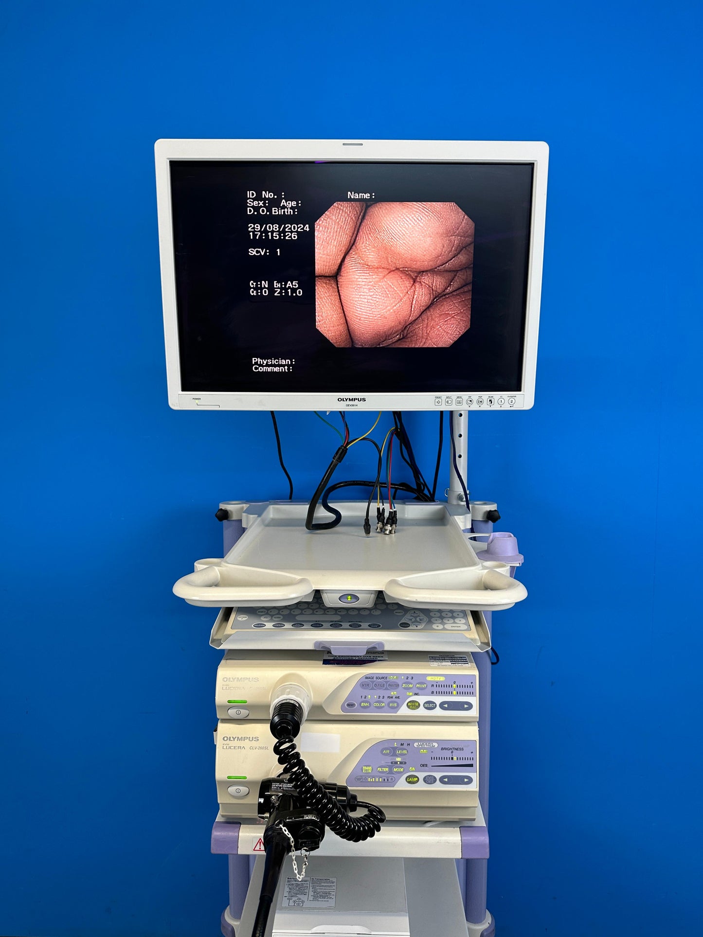 Olympus LED Monitor shows Excellent display of the endoscope view