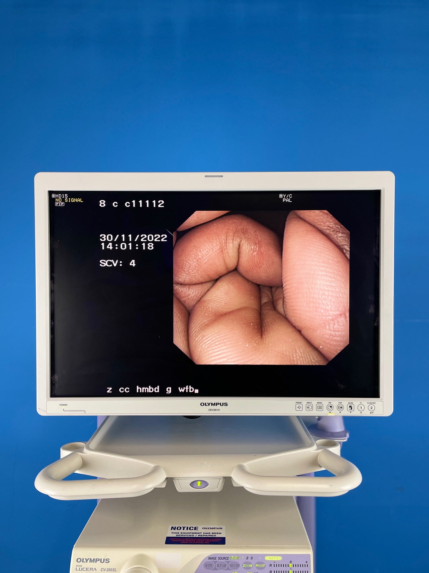 Olympus OEV261H LED Endoscopy Monitor