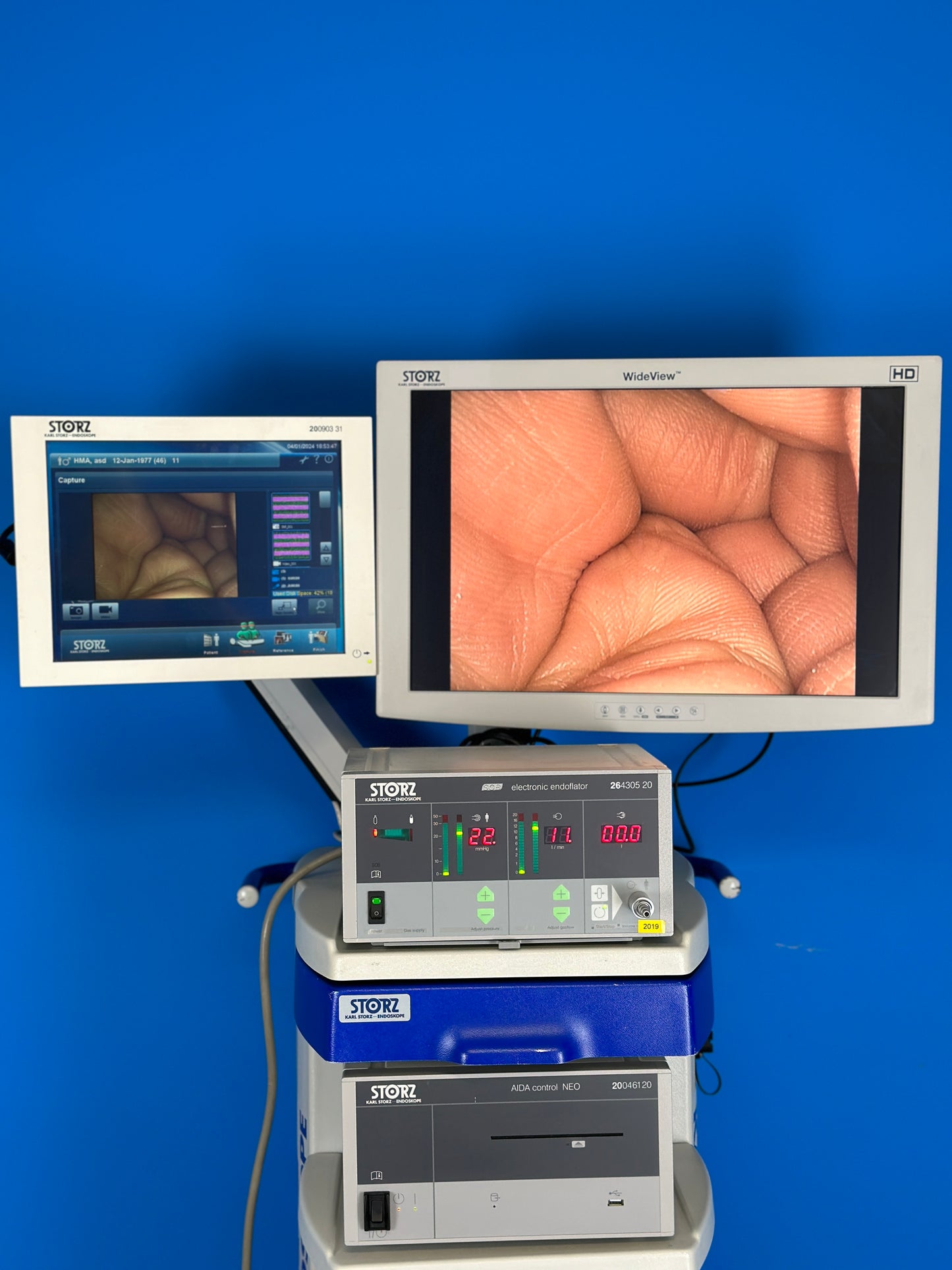 Storz Wideview HD Touch screen good quality images are displayed on these LCD monitor