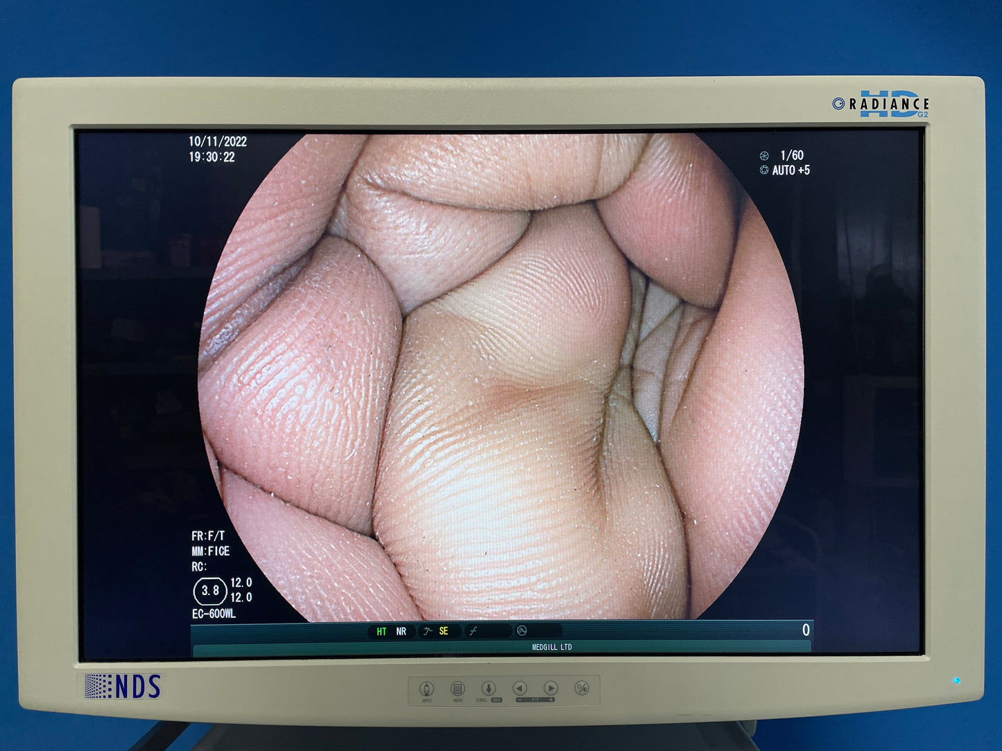 Storz LED Monitor Shows excellent view on the screen