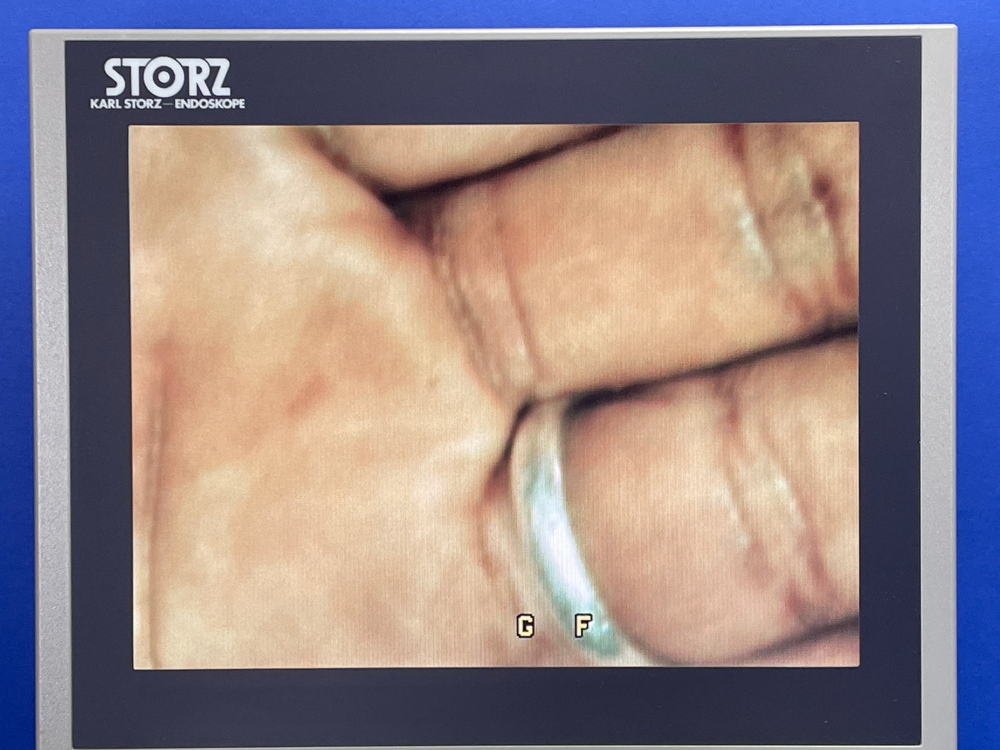 FULL HD touch monitor Integrated LED light source