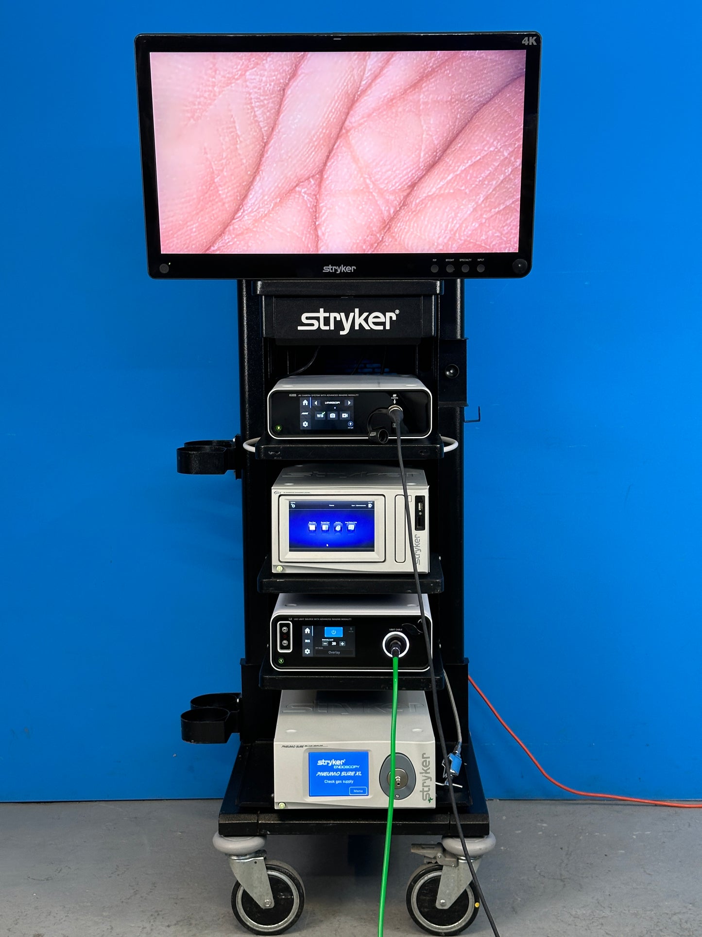 Stryker 1688 AIM 4K Laparoscopy Stack System displaying 4K Video Image is an advanced endoscopic camera system designed to deliver high-quality live video during surgical endoscopic procedures.