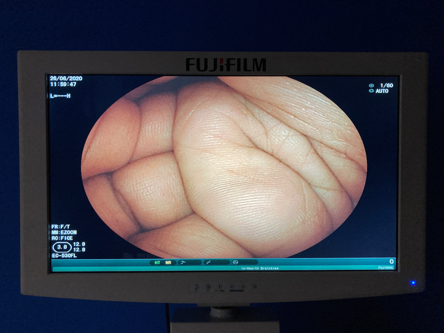 Fujinon 26'' monitor shows excellent image on the screen
