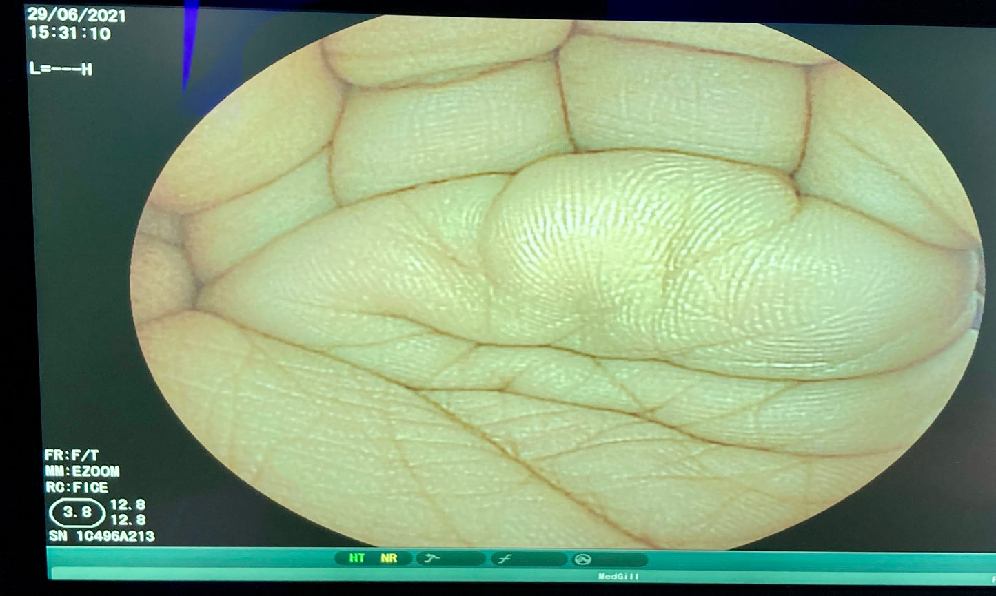 Clear Image view of the surgical area with FICE dual mode