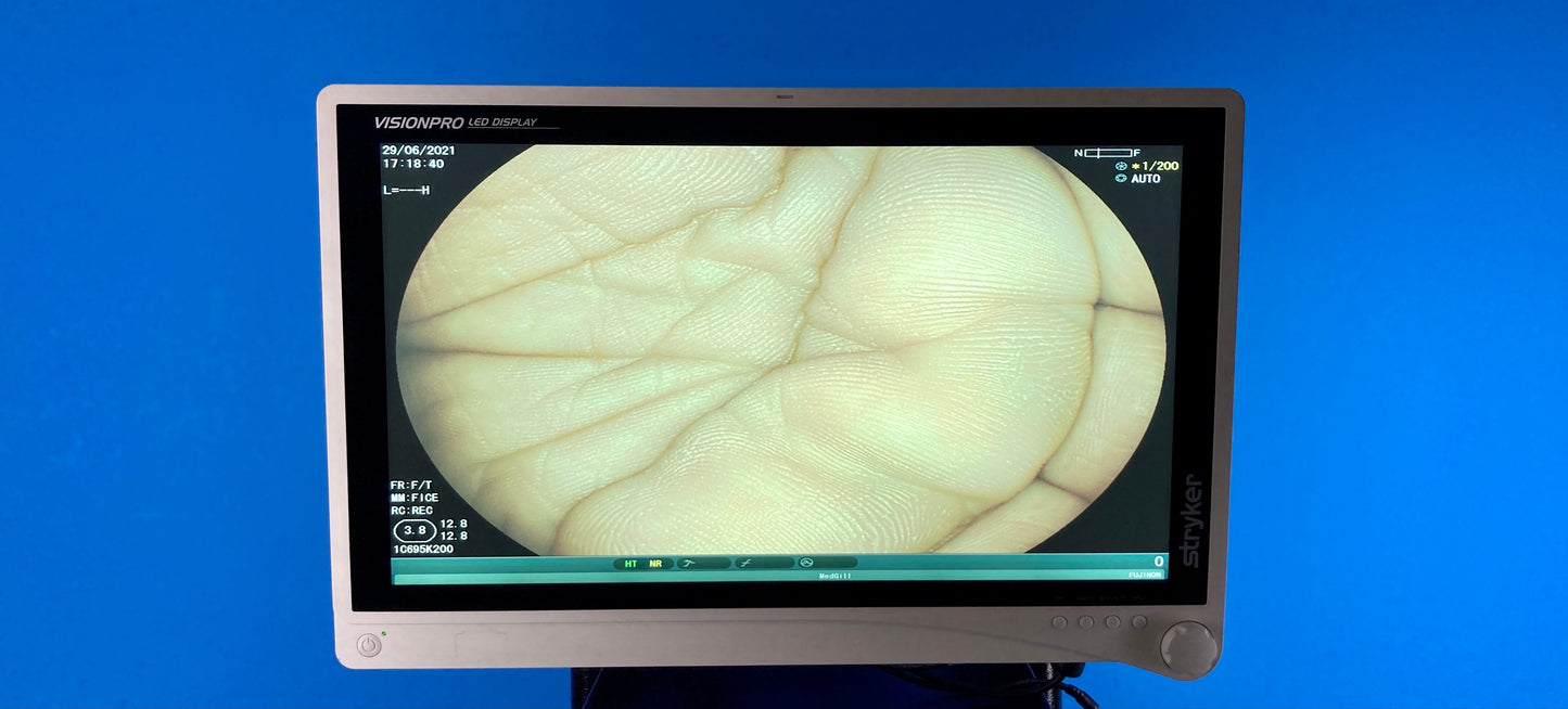 Stryker VisionPro LED Display