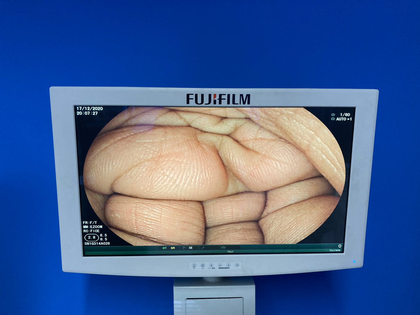 clear image display Fujifilm’s Endoscope Visualization System