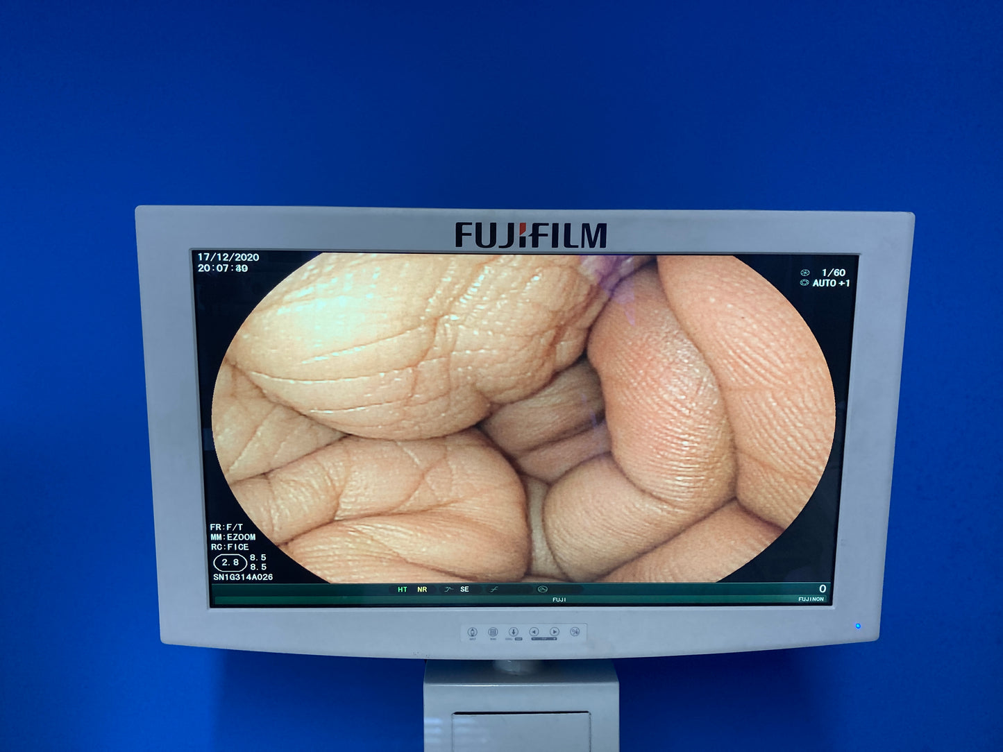 Videogastroscopio Fujinon EG-530FP