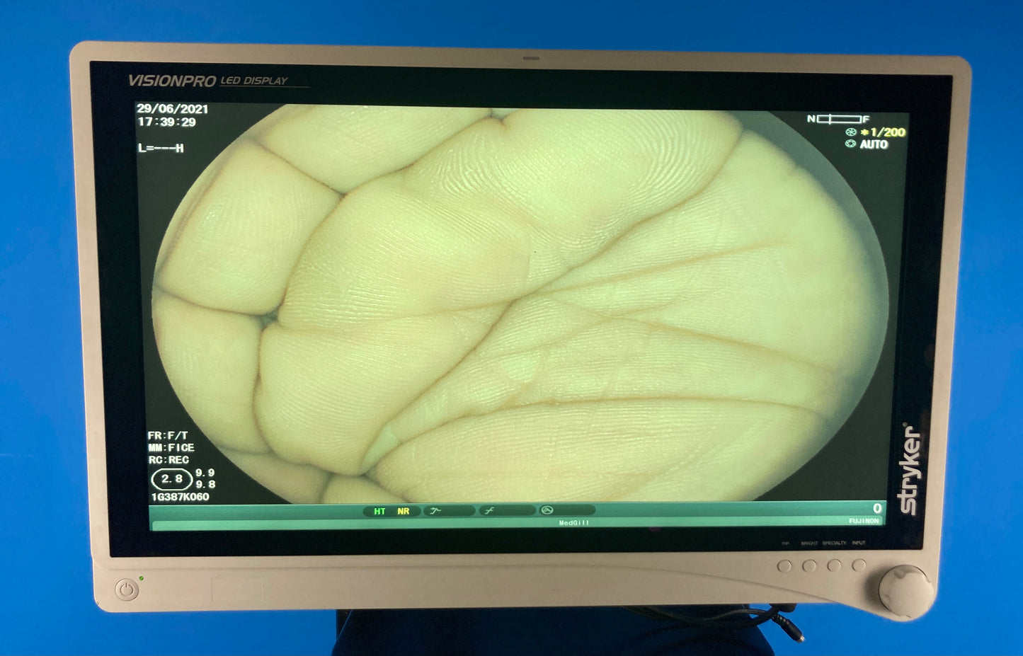 Stryker Visionpro LED Monitor Video center Endoscope Visualization System displays