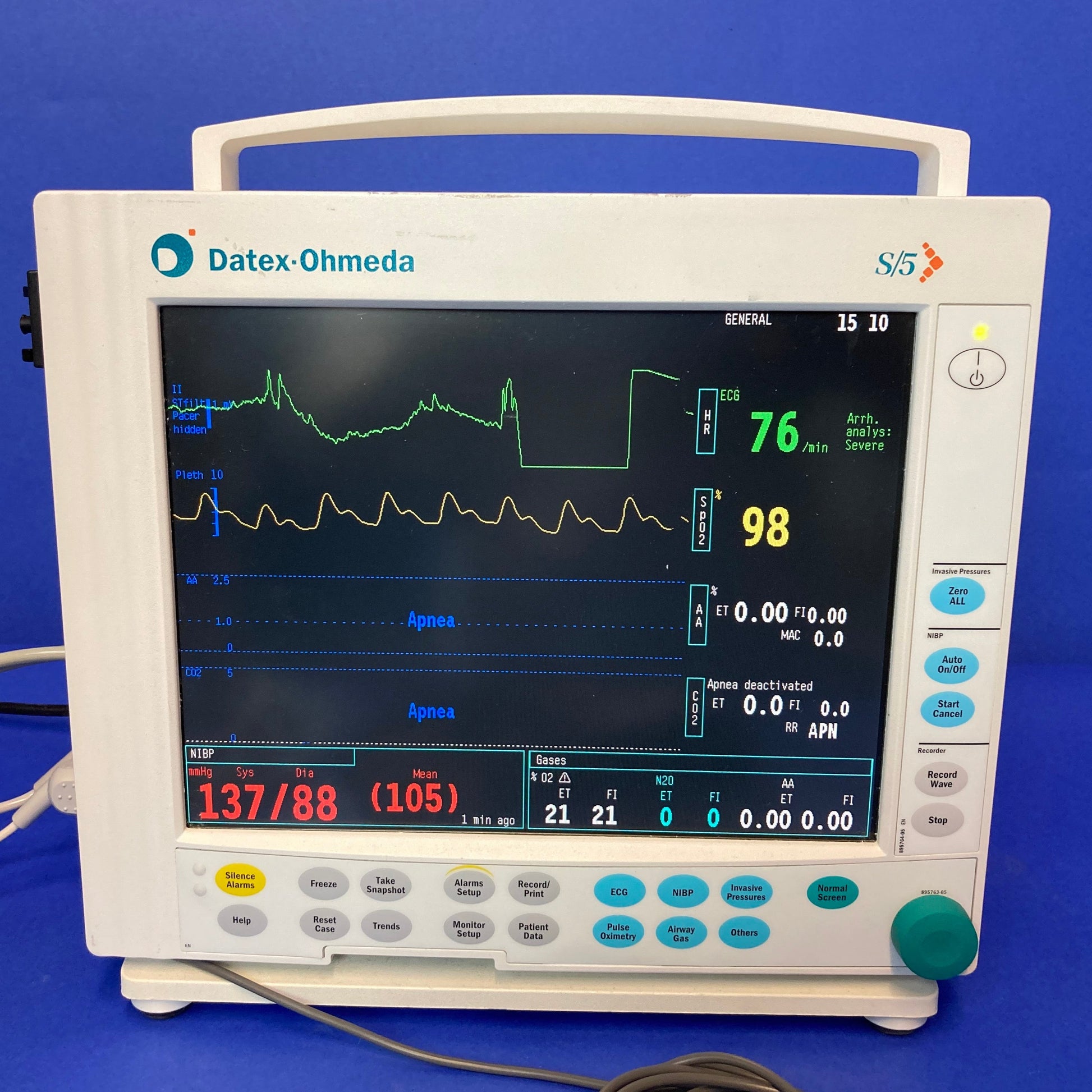 Datex - Ohmeda S/5 Four display options with integrated monitor controls: 15" or 17" high resolution color video display and 10.4" or 15" flat panel color LCD display