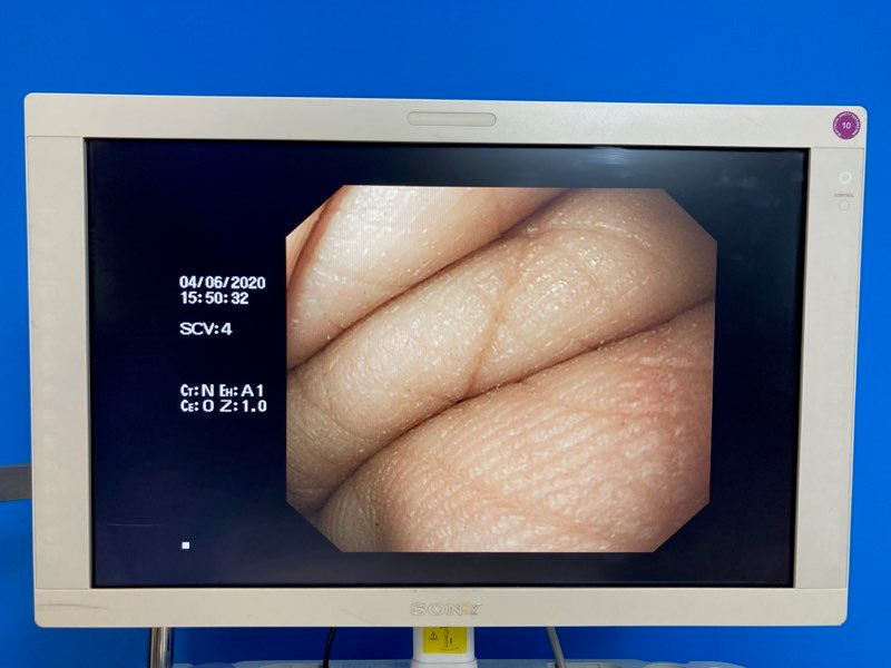 Sistema de endoscopia Olympus Evis Lucera CV 260SL con gastroscopio Olympus GIF H260