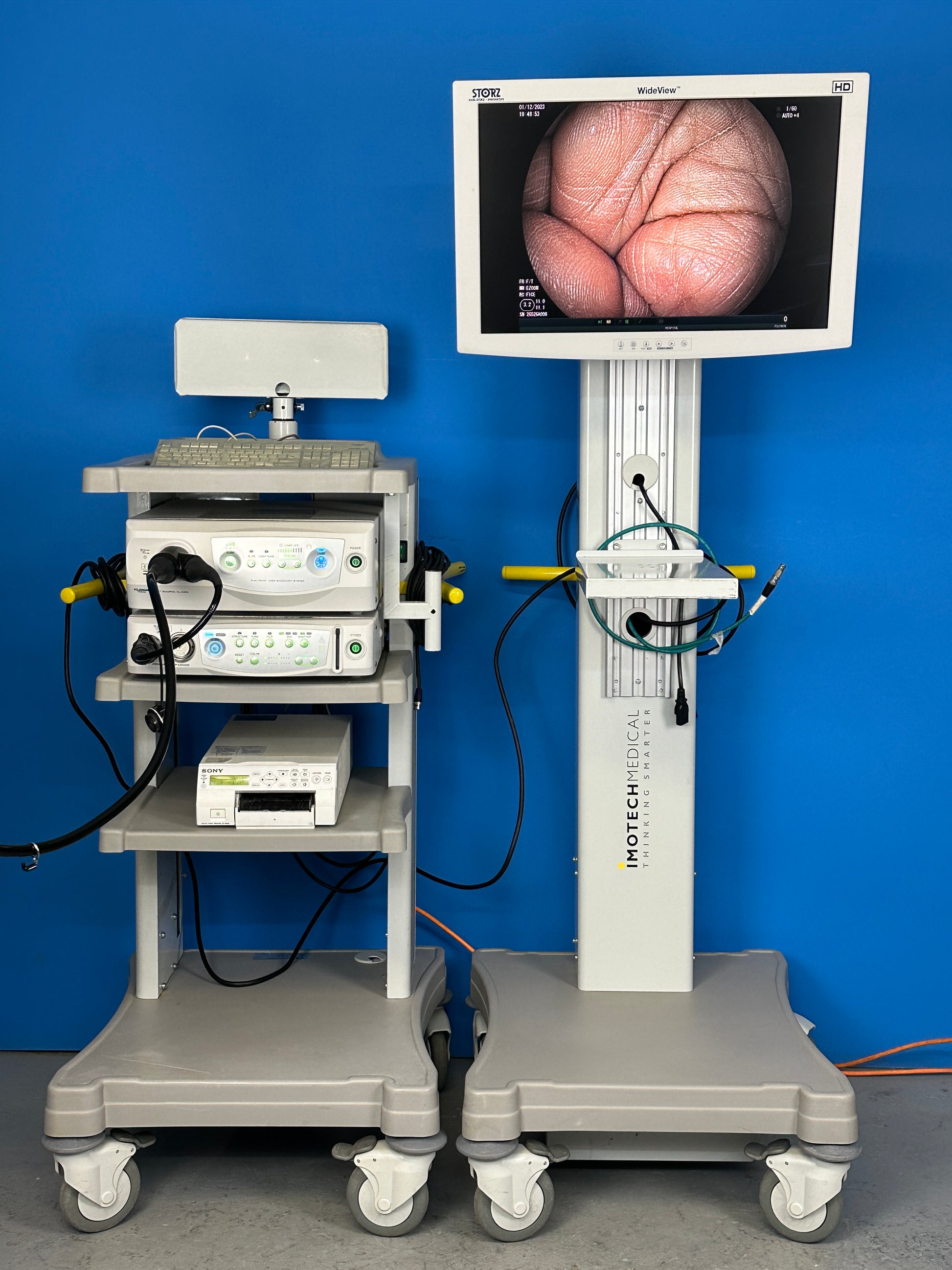 Fujinon 4450HD endoscopy system showing image quality of flexible video gastroscope of Fujifilm