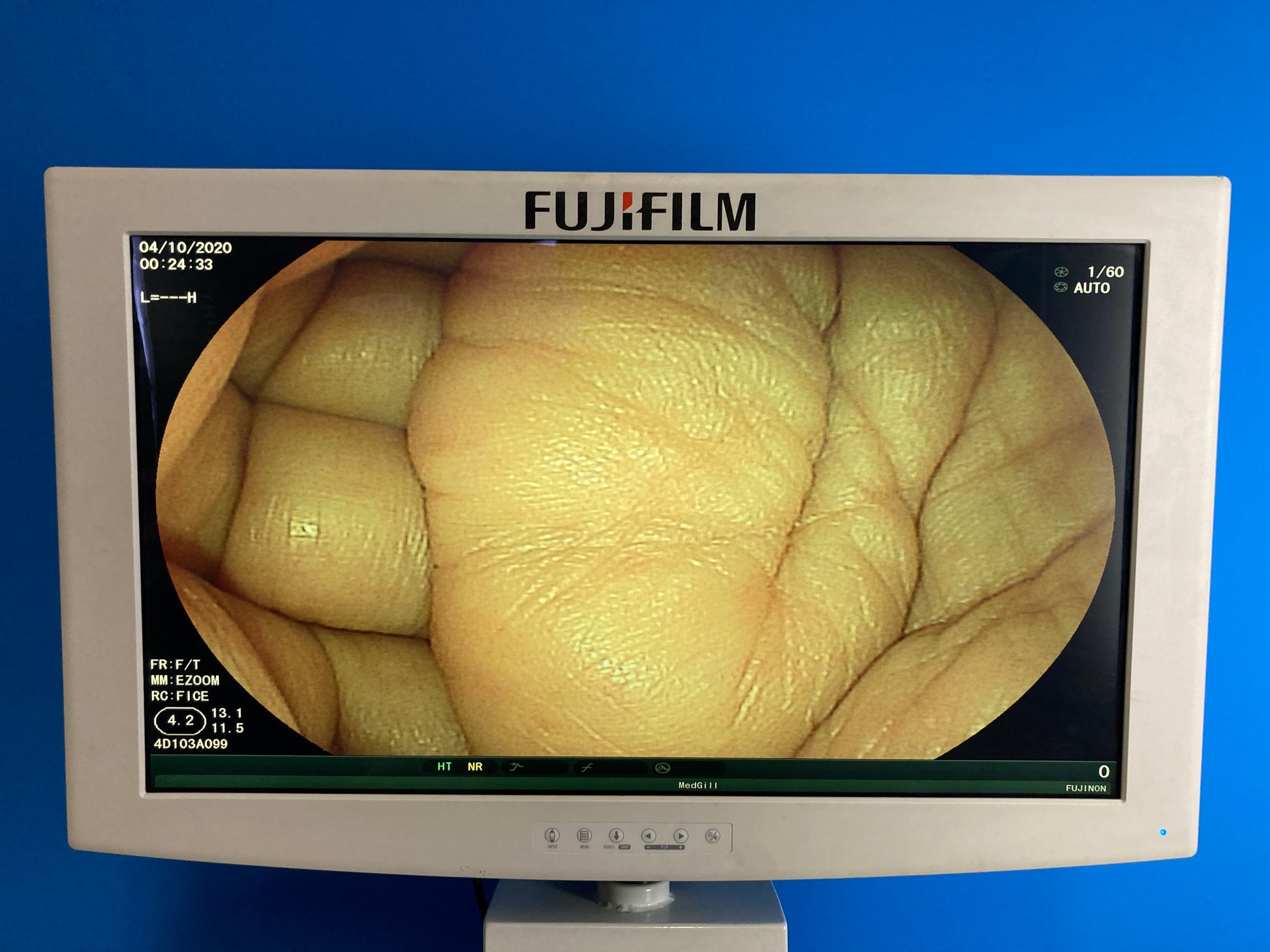Fujifilm LCD monitor Video center Visualization System displays