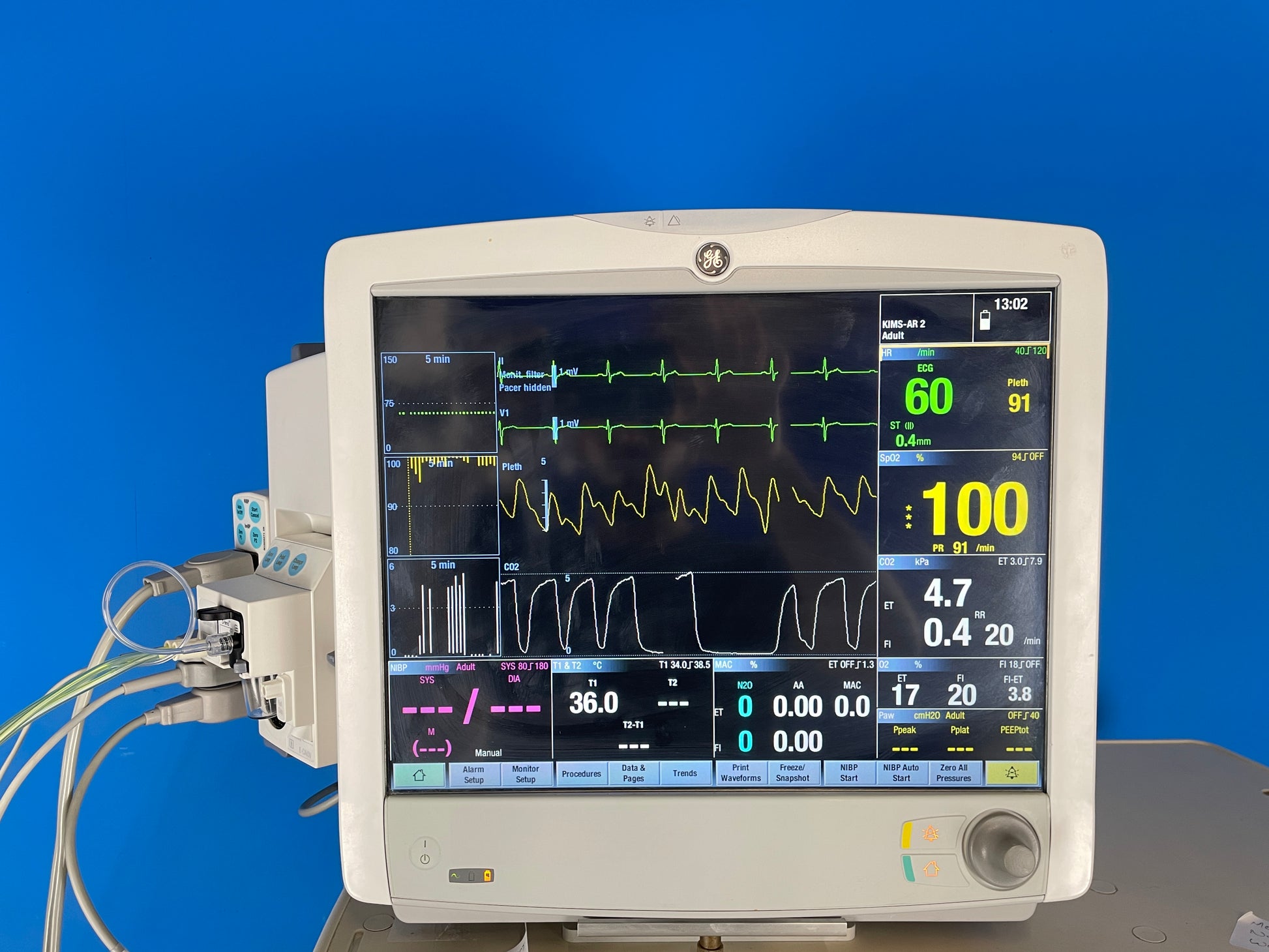 GE Carescape B650 Anesthesia Touch screen Monitor  showing different parameters