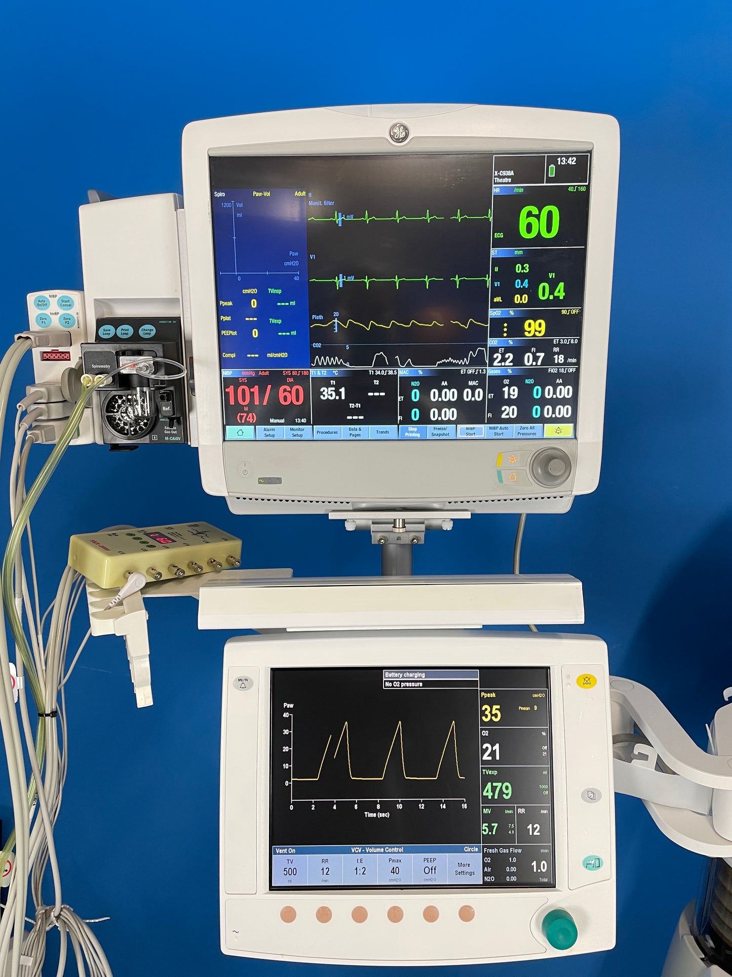 Anesthesia B650 Monitor with modules and Aespire View uses the GE SmartVent 7900 as the ventilator system for the anesthesia machine.