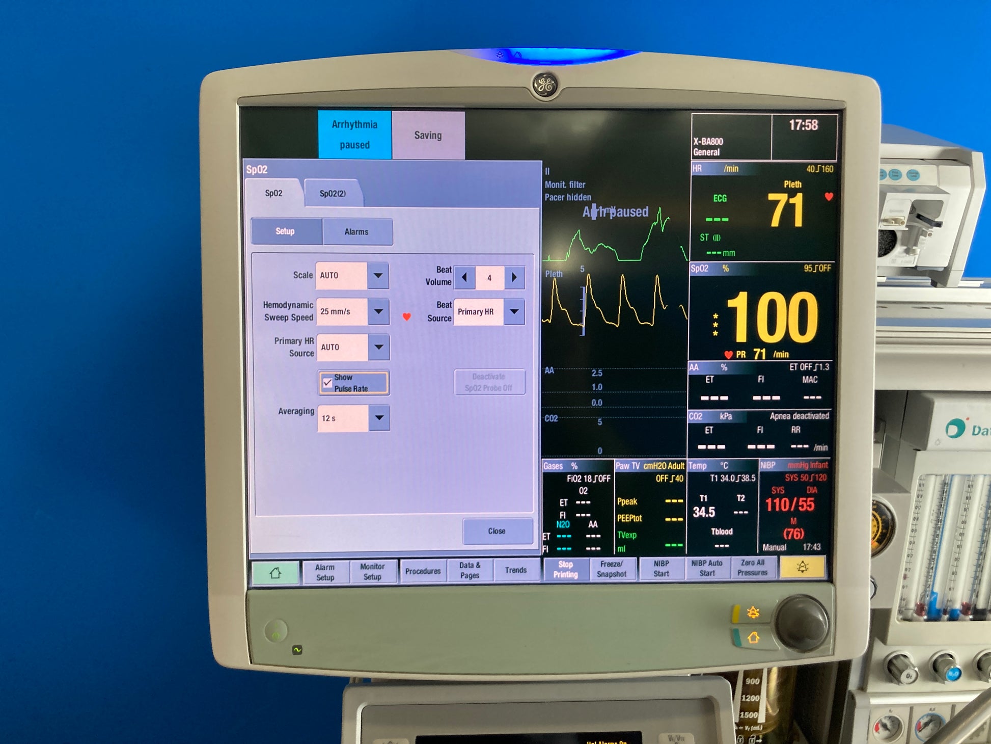 GE Carescape B850 Anesthesia Monitor show excellent result and works properly  with Modules