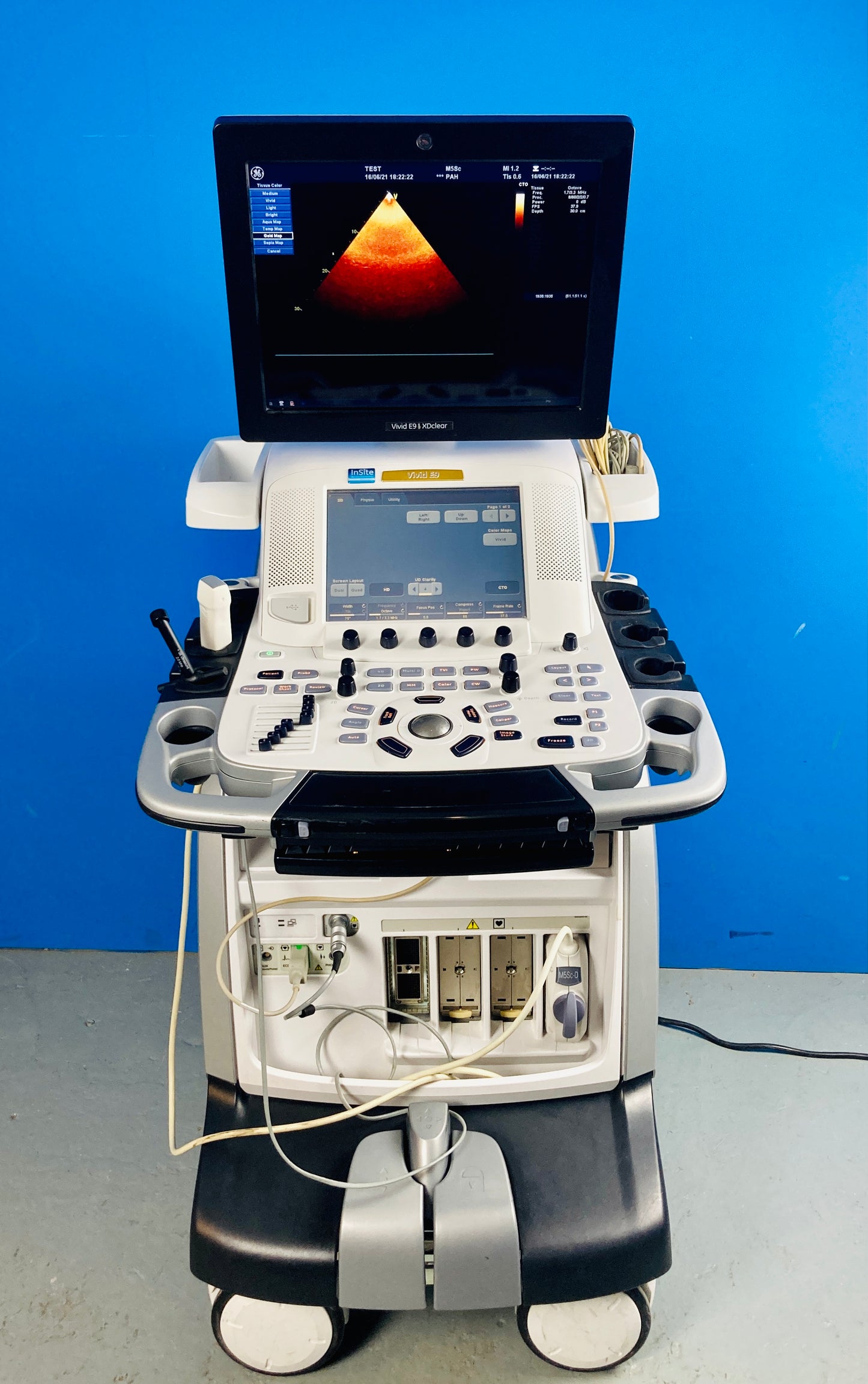 GE Vivid E9 XDclear is a cardiovascular ultrasound system designed for 4D imaging. It offers streamlined workflow, increased productivity, and accurate data for confident diagnoses.