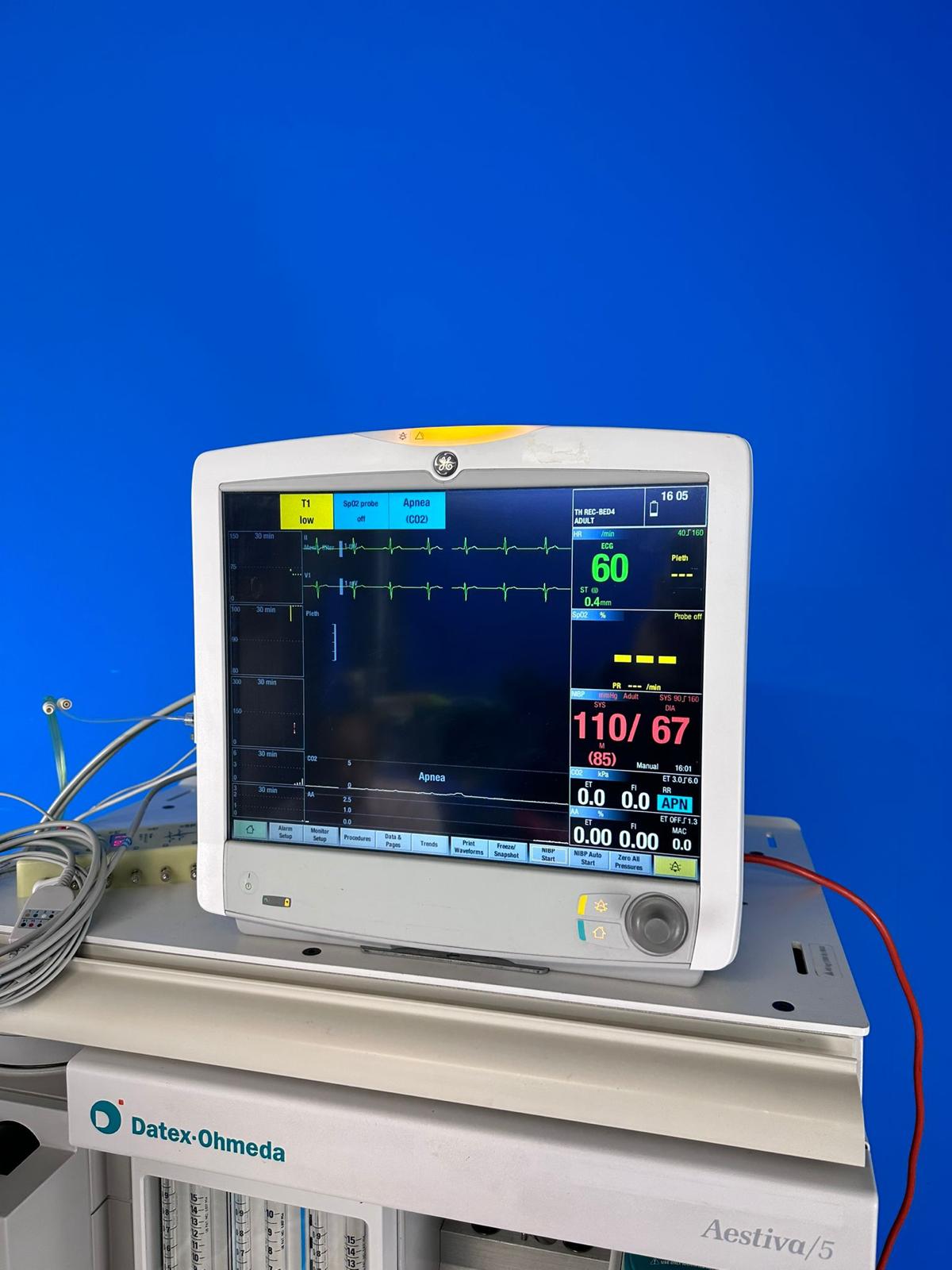 Auto View on Alarm (AVOA) automatically shares high priority alarms within the care unit, CARESCAPE Patient Data Module provides consistent hemodynamic measurement during intra-hospital transport and also transfers trend data