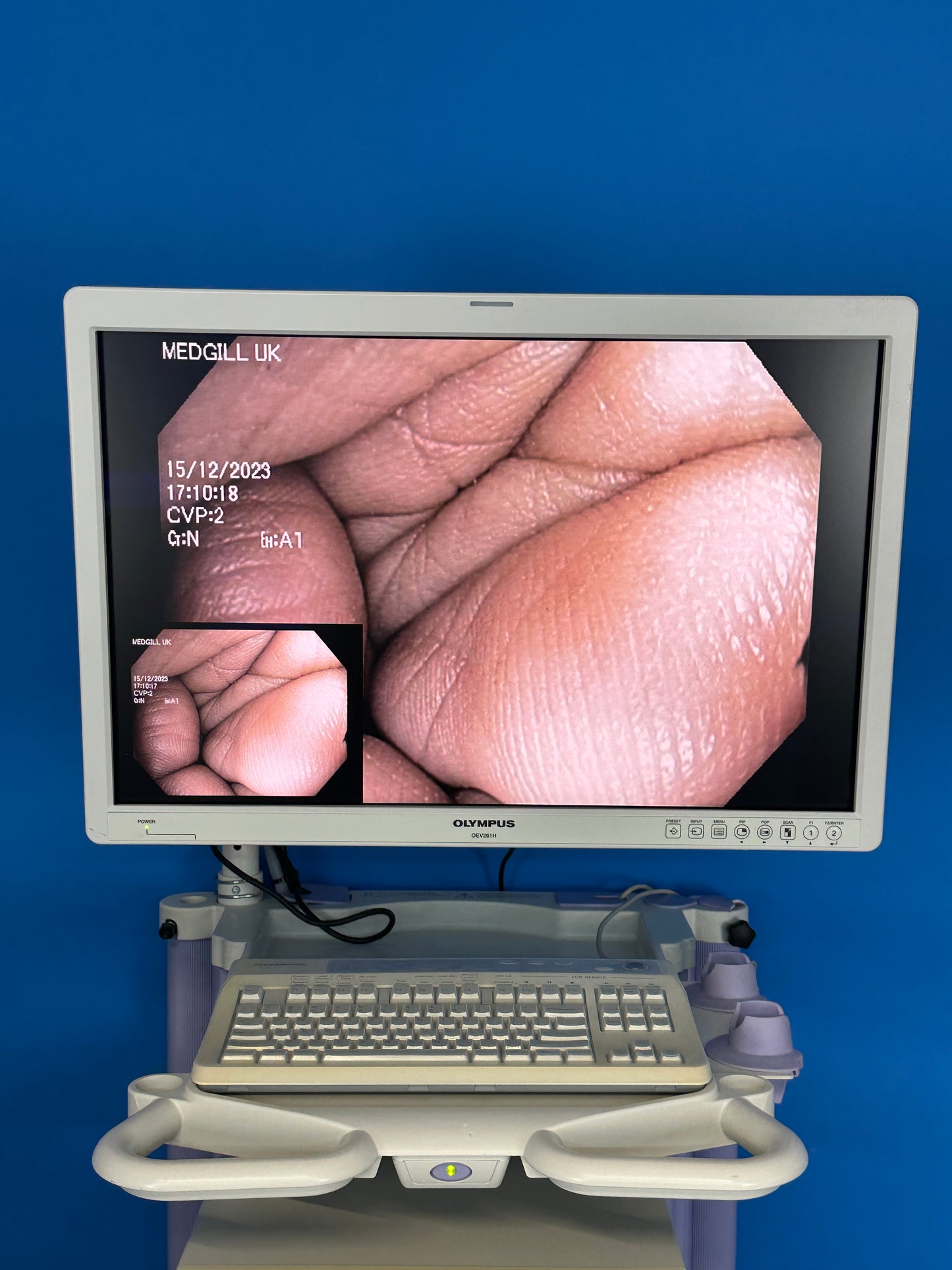 picture in picture VIP display BIP display BIP display PIP display for any combination offenders copy images for endoscopic images fluoroscopic images, ultrasound images, laparoscopic images and images from the endoscope position-detecting unit