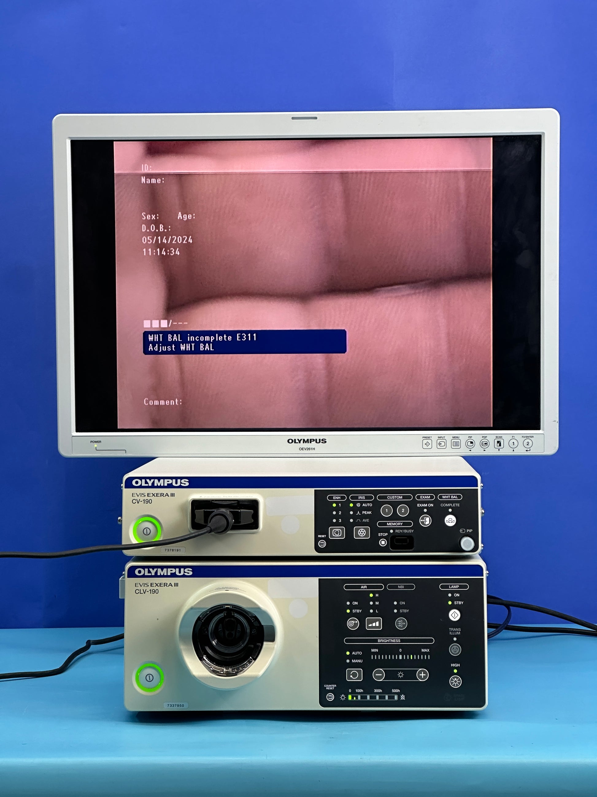 Olympus CV-190 with CLV-190 EVIS EXERA III Video Endoscopy System, Olympus OEV-261H is a 26” LCD monitor able to display full High Definition (HD) images and has been designed specifically for use with Olympus endoscopy systems