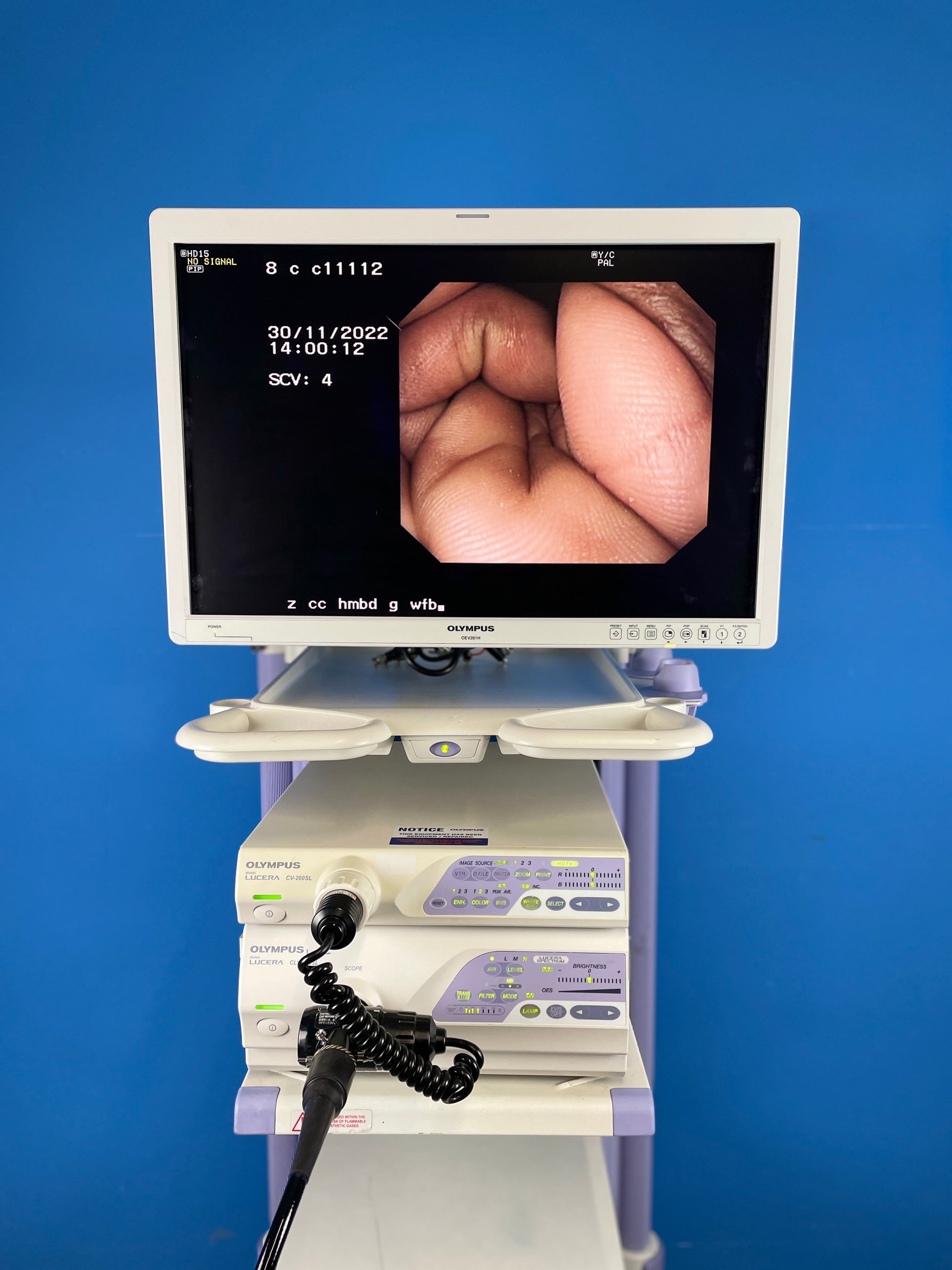 OEV 261H and CV 260SL with Olympus CLV 260 Showing endoscopy image