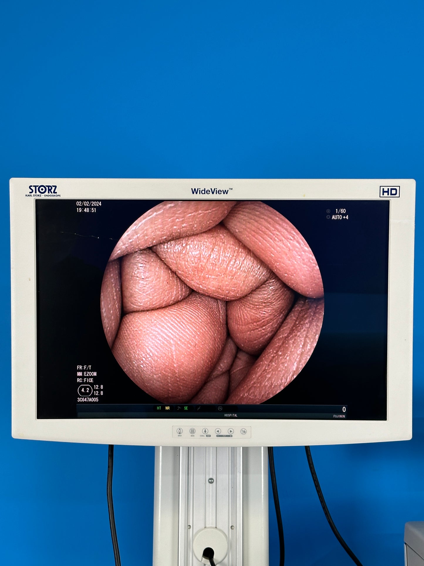 Shows excellent View of the procedure on the screen 