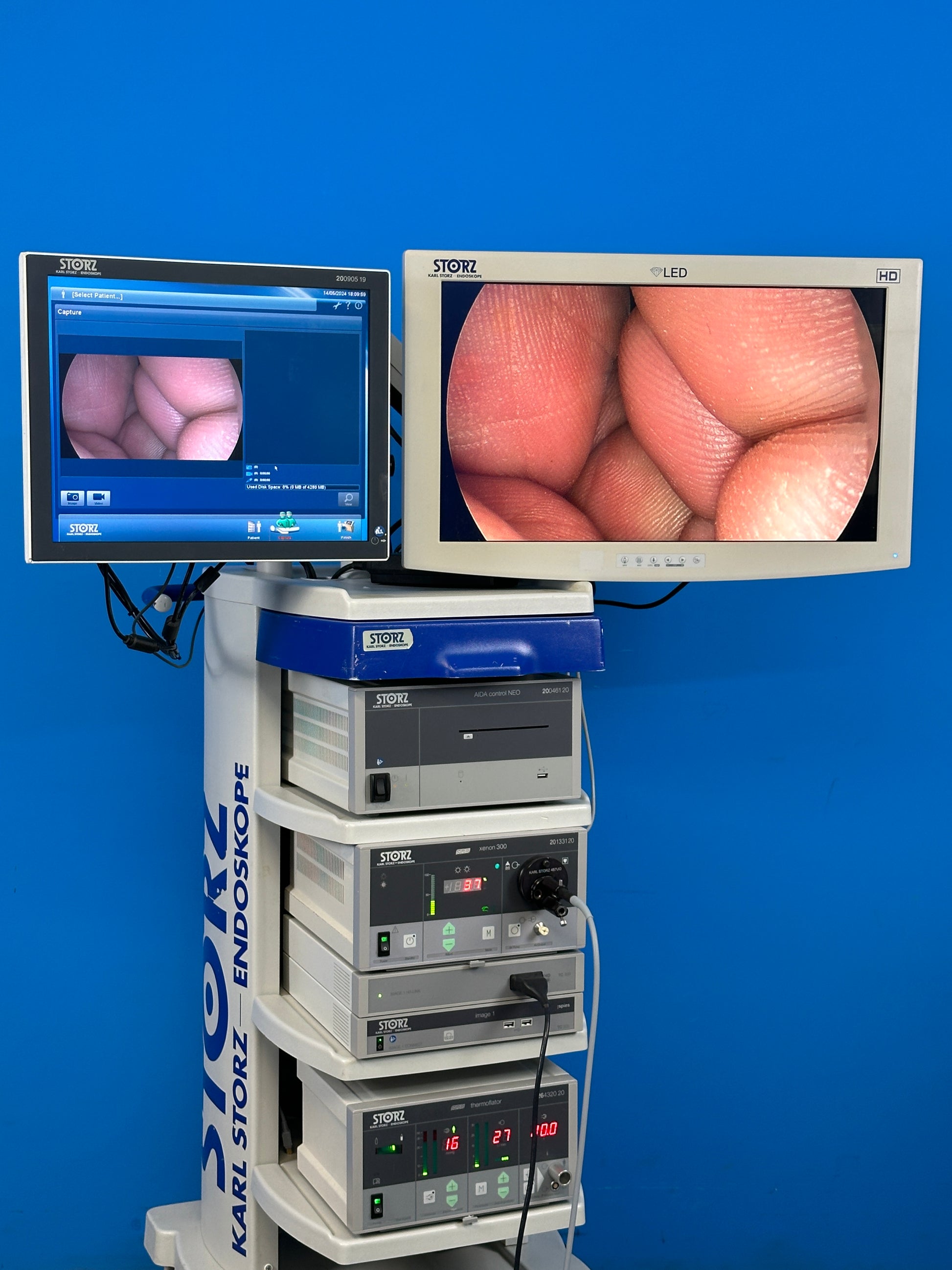 Storz spies IMAGE1 S™ is a modular camera platform that combines various technologies (e.g., rigid, flexible, and 3D endoscopy as well as FULL HD and 4K imaging). NIR/ICG Fluorescence.