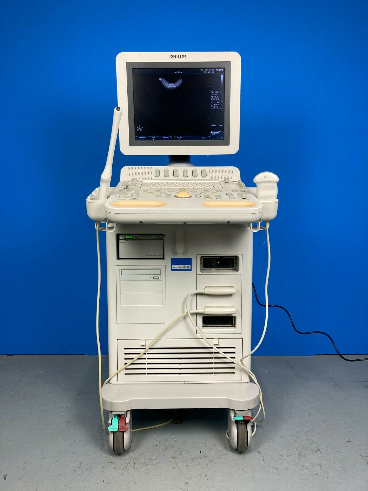 Phillips HD7 XE Ultrasound machine.