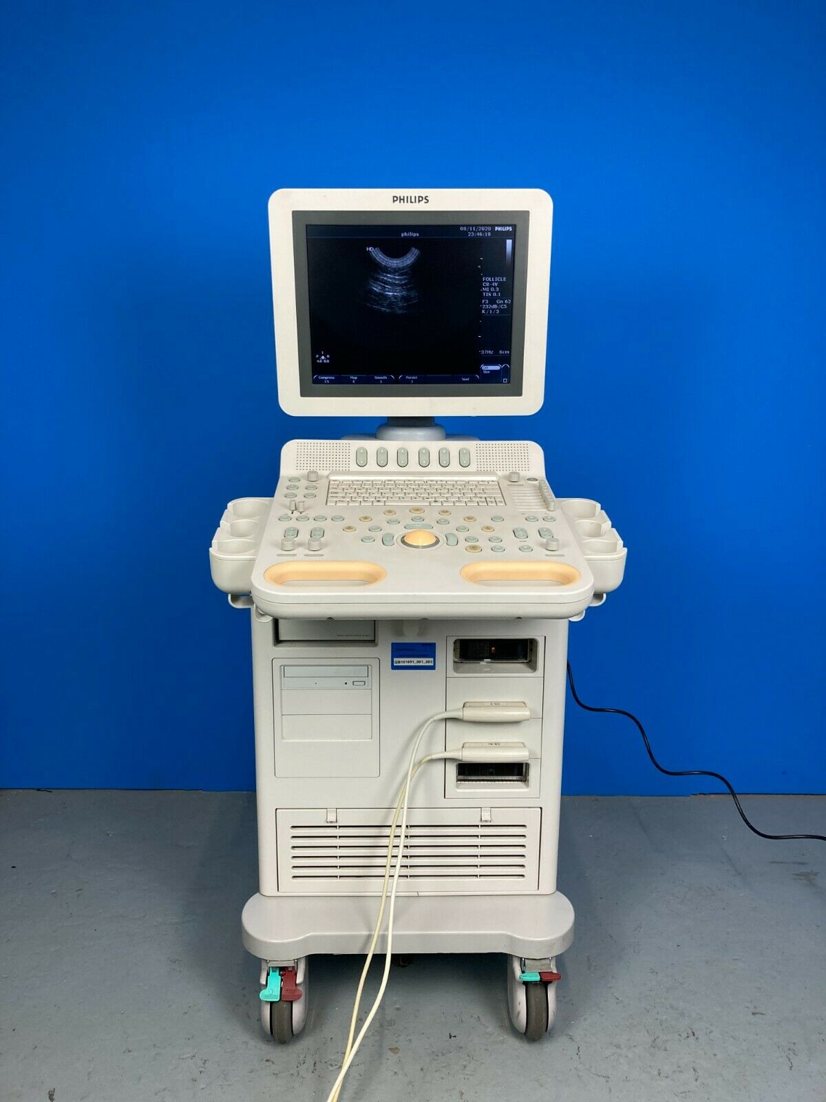 Phillips HD7 XE Ultrasound machine.