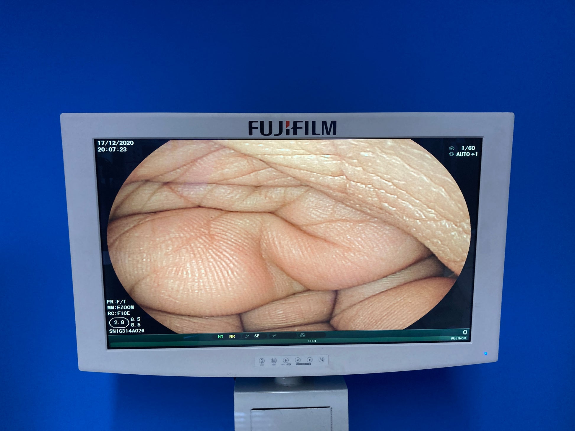Fujifilm’s Endoscope Visualization System displays