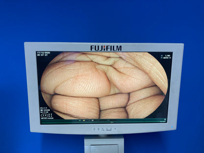 clear image display Fujifilm’s Endoscope Visualization System 