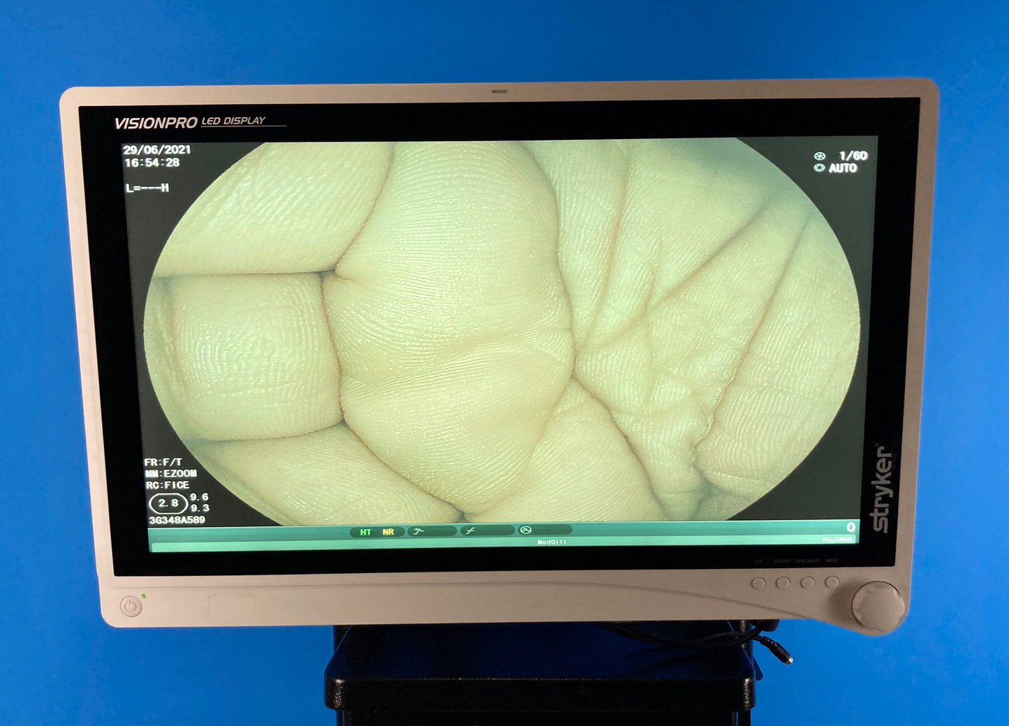 Stryker Visionpro LED Monitor Video center Endoscope Visualization System displays with FICE dual mode