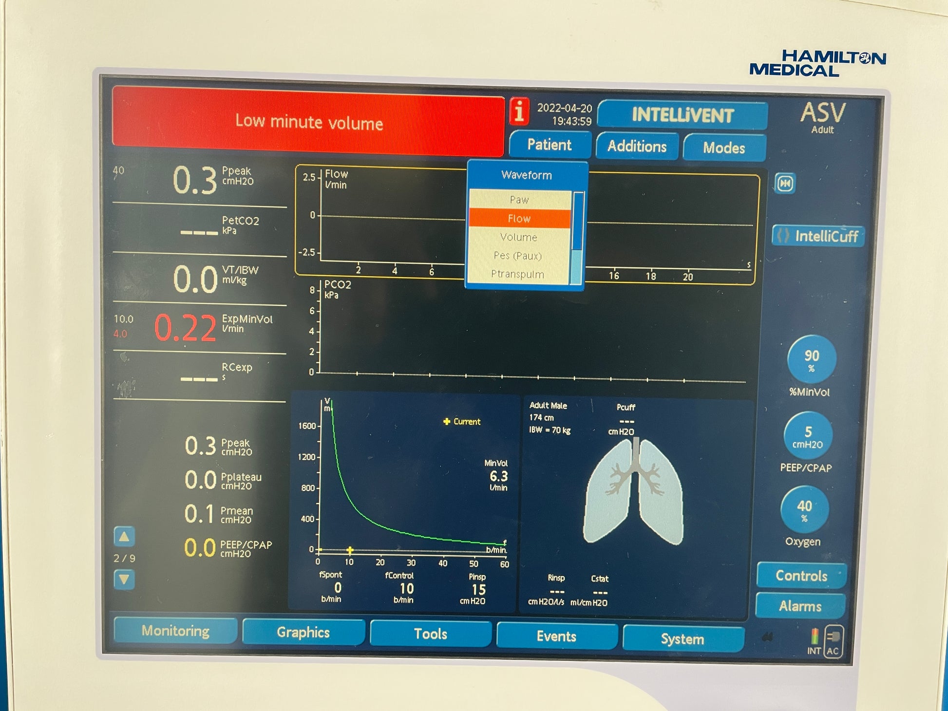 G5 Ventilator features with Graphical waveform and artificial lung on touch screen