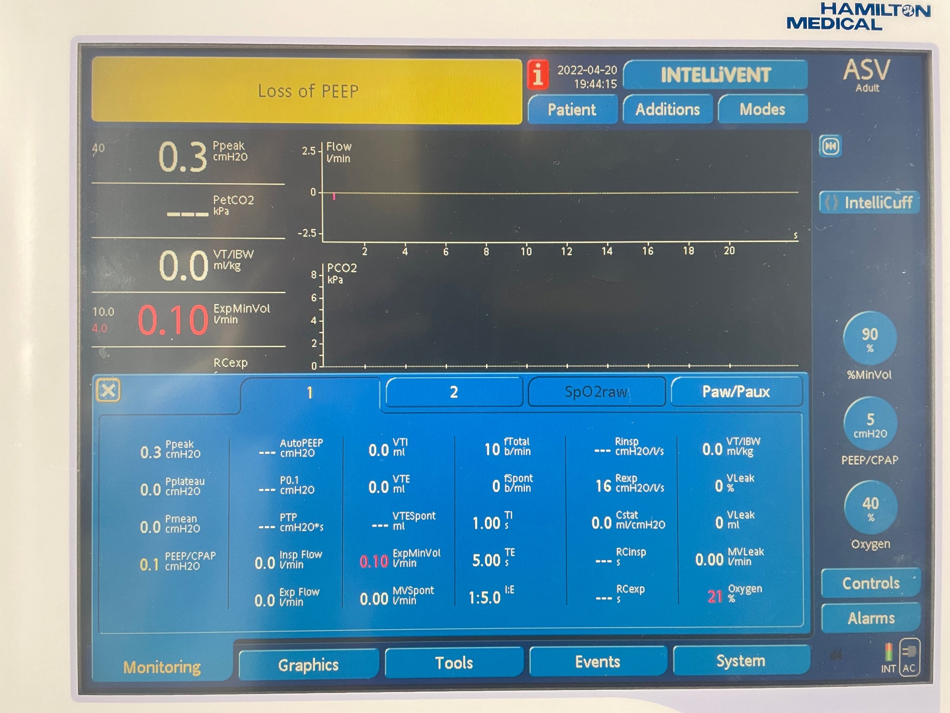 G5 Monitoring  Patient Values  control Alarms parameters 