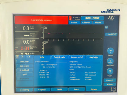 G5 ICU Ventilator additonal features shown on screen