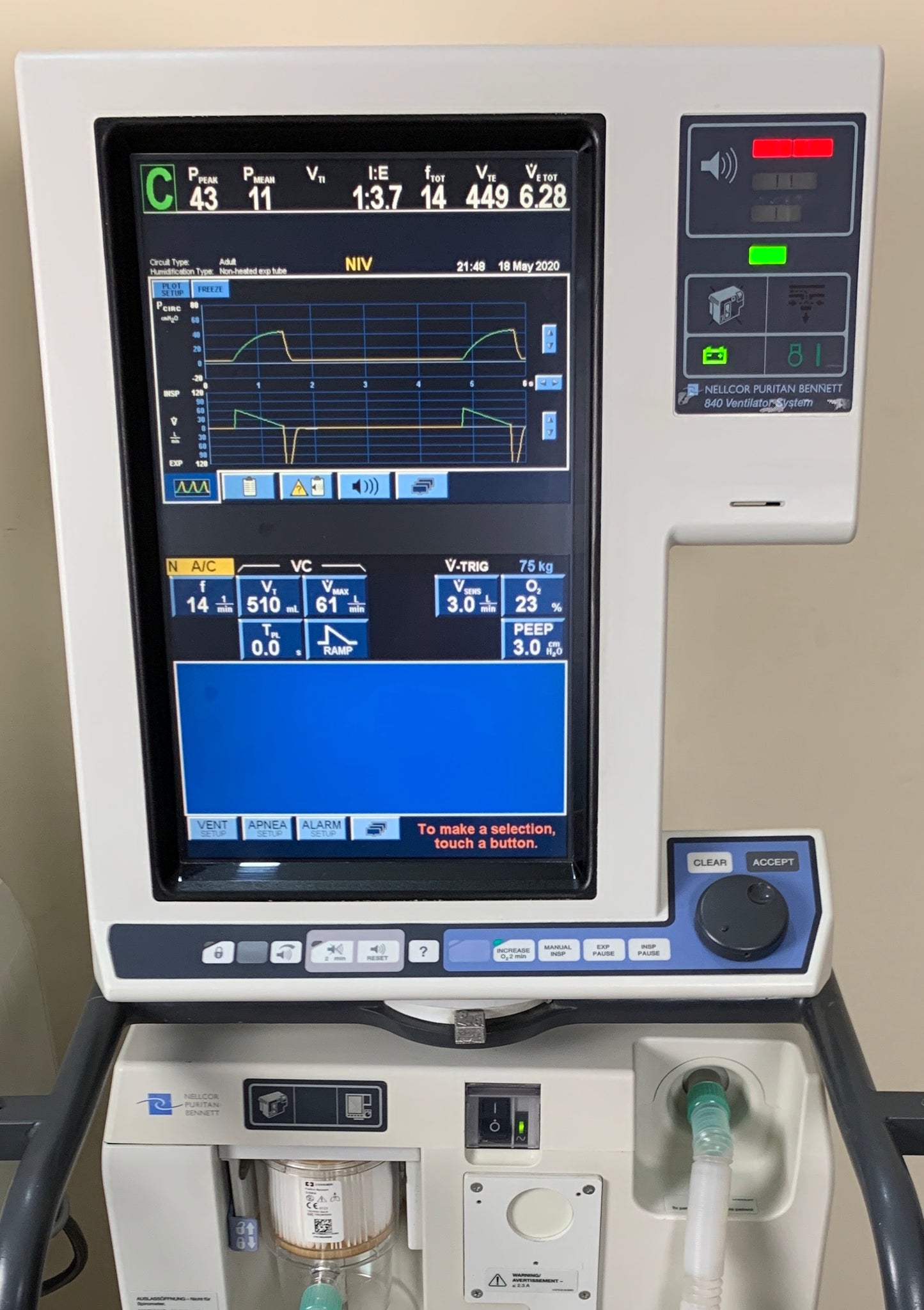 Bennett 840 ICU Ventilation Modes