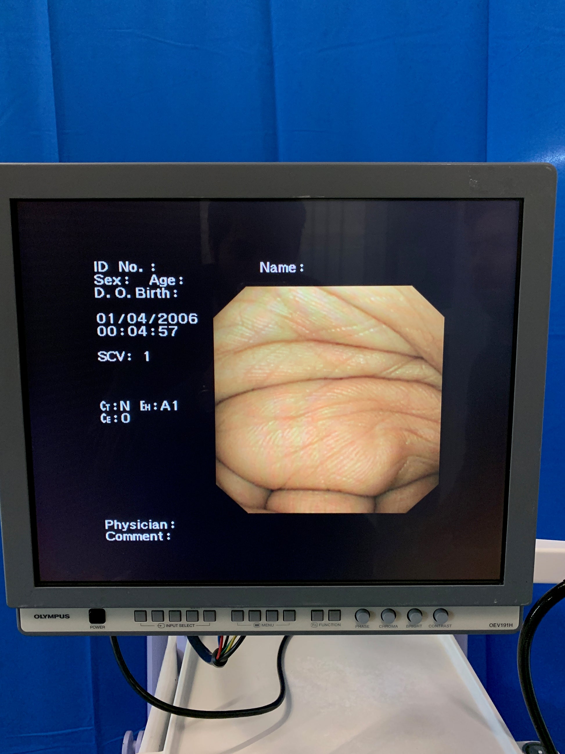 HD / SD SDI output Possible with adapter 