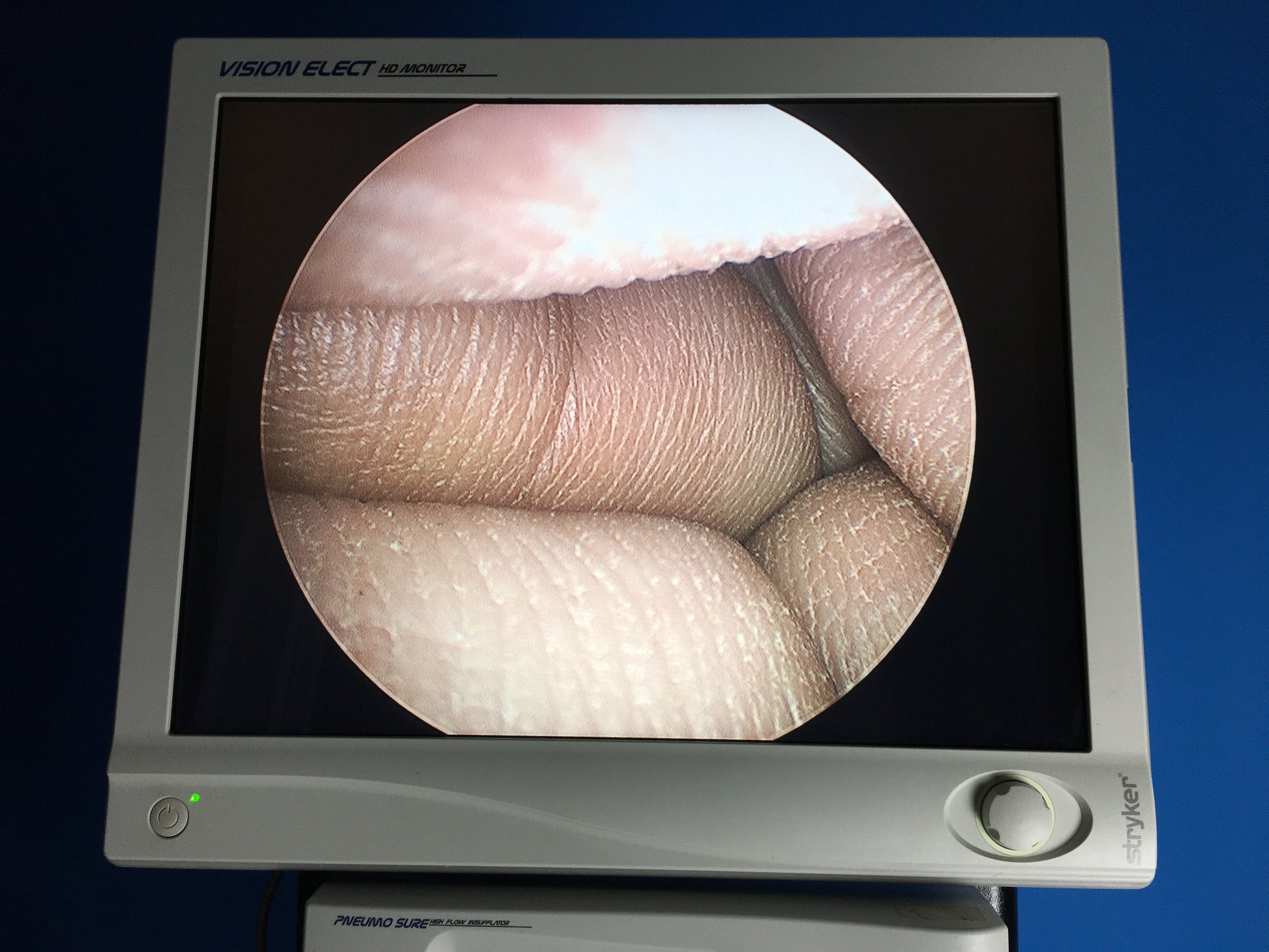 A wide screen  surgical display that can support a maximum resolution and create excellent image.